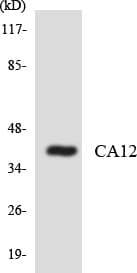 IHC-plus™ CA12 / Carbonic Anhydrase XII Antibody (aa224-273)