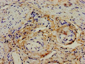 IL12A / p35 Antibody