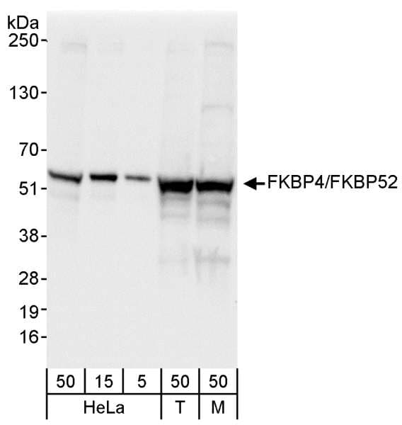 IHC-plus™ FKBP4 / FKBP52 Antibody (aa1-50)
