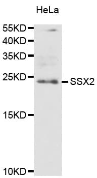 Polyclonal Rabbit anti-Human SSX2 Antibody (IHC, IF, WB)