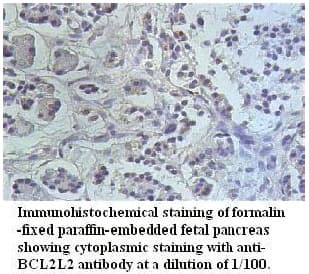 Polyclonal Rabbit anti-Human BCL2L2 / Bcl-w Antibody (IHC)