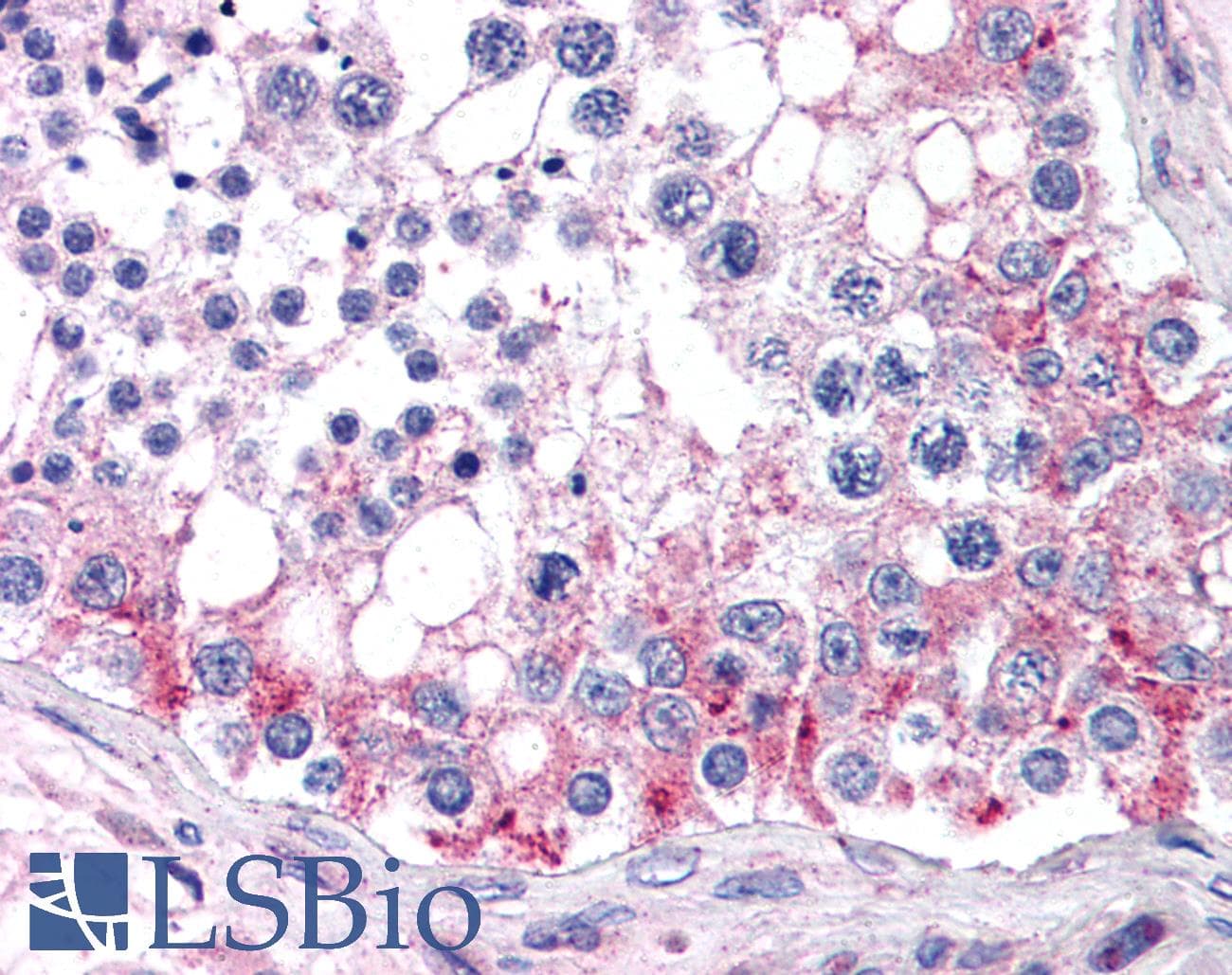 IHC-plus™ ABCB9 Antibody (aa757-769)