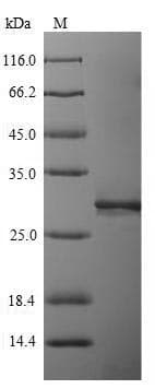 Human LILRA5 Protein (Recombinant 6His, N-terminus)