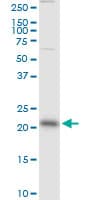 RAB13 Antibody (clone 8H8)