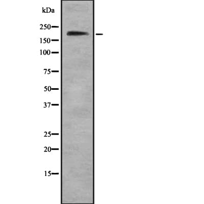 TRPM7 Antibody