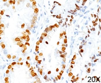 Monoclonal Mouse anti-Rat NKX2-1 / Thyroid-Specific TF Antibody (clone 8G7G3/1, Ready-to-Use, IHC)