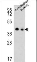 IHC-plus™ SLC25A19 Antibody (aa236-263)
