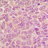 Polyclonal Rabbit anti-Human PRKD1 / PKC Mu Antibody (C-Terminus, IHC, WB)
