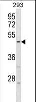 Polyclonal Rabbit anti-Human HORMAD1 Antibody (aa161-189, WB)