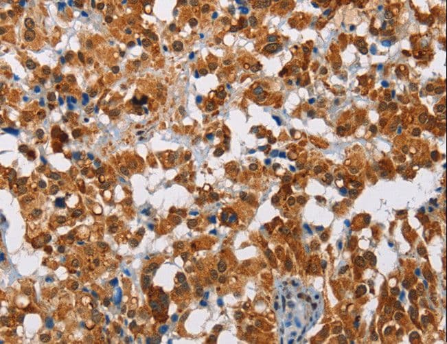 Polyclonal Rabbit anti-Human ATXN1 / SCA1 Antibody (IHC)