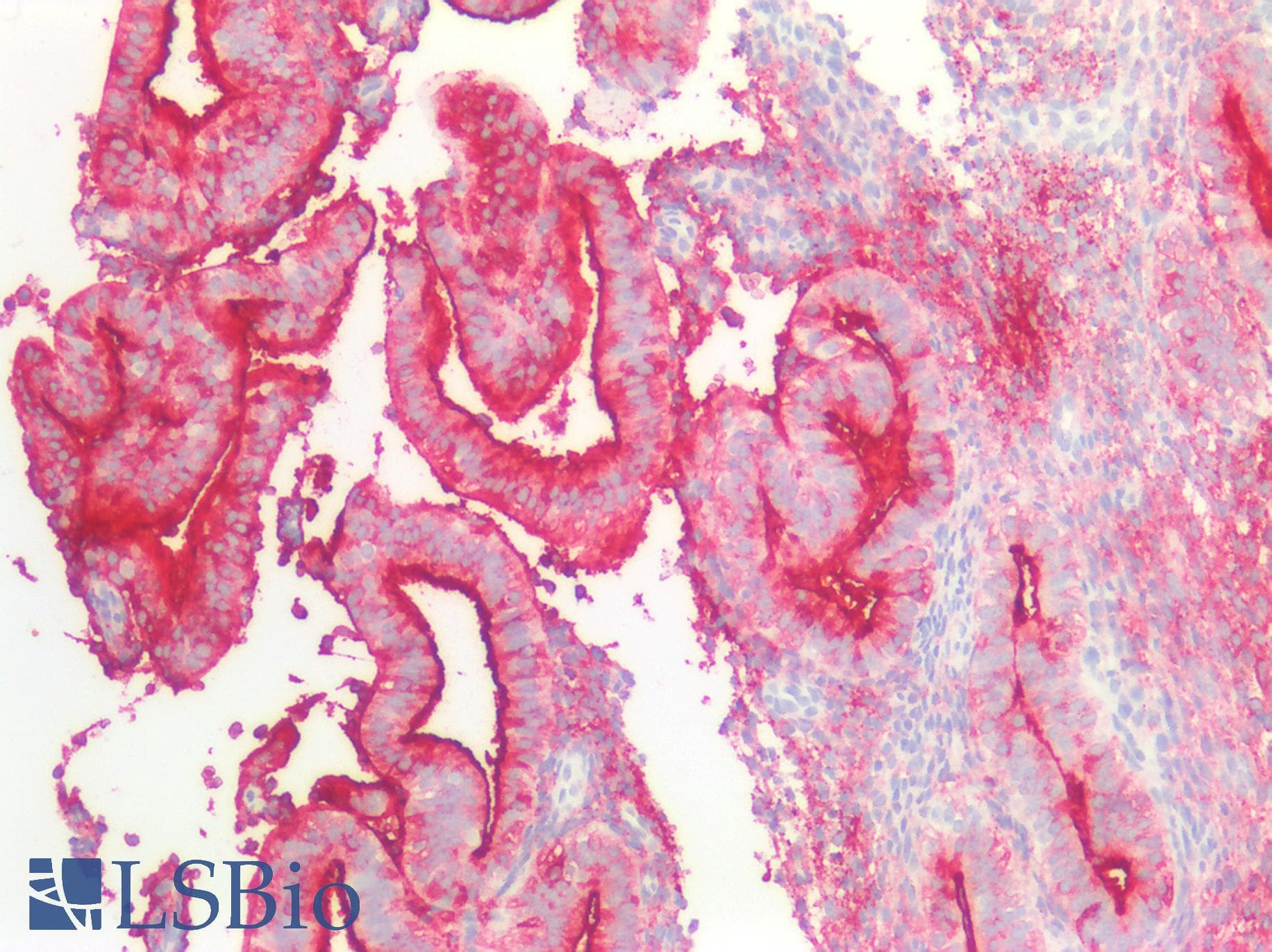 PathPlus™ EMA / MUC1 Antibody (clone B24.1)
