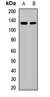 SART3 Antibody