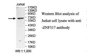 Polyclonal Rabbit anti-Human ZNF317 Antibody (aa58-266, IHC, WB)