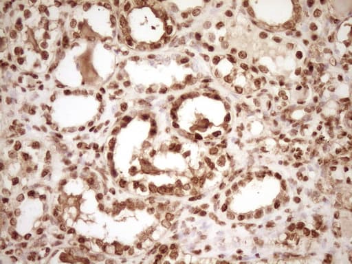 SAE1 Antibody (clone OTI6C7)