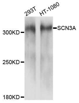 Polyclonal Rabbit anti-Human SCN3A / Nav1.3 Antibody (WB)