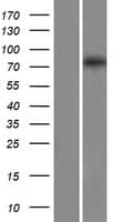 EXOC8 / EXO84 Protein (Over-Expression Lysate Myc-DDK (Flag))