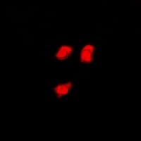 FMR1 / FMRP Antibody