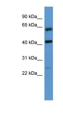 RAIG2 / GPRC5B Antibody (aa61-110)