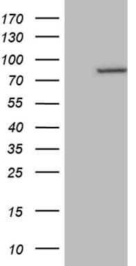 RPS6KA2 / RSK3 Antibody (aa1-51, clone OTI2H3)