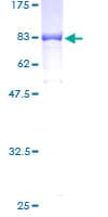 Human GIT2 Protein (Recombinant GST)