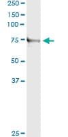 TNXB / Tenascin XB Antibody (clone 2D3-1B10)
