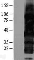 HEXIM2 Protein (Over-Expression Lysate Myc-DDK (Flag))