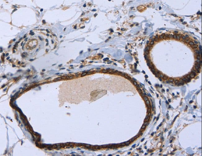 MAPRE3 / EB3 Antibody