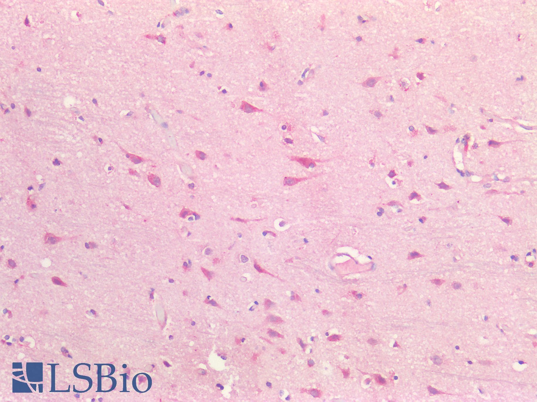 PathPlus™ BDNF Antibody