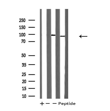 Polyclonal Rabbit anti-Human TOP1 / Topoisomerase I Antibody (IF, WB)