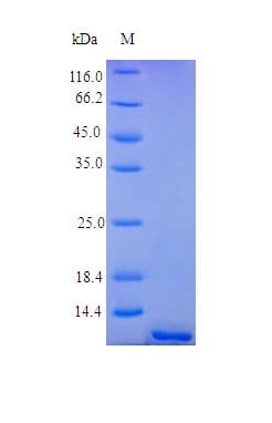 Human TNFRSF17 / BCMA Protein (Recombinant)