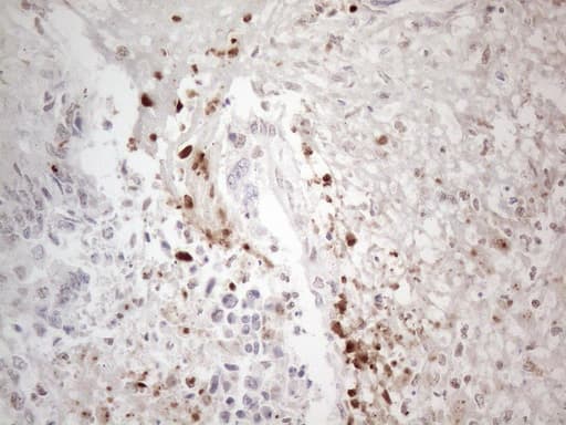 NR2C2 / TAK1 Antibody (aa1-241, clone OTI4B1)