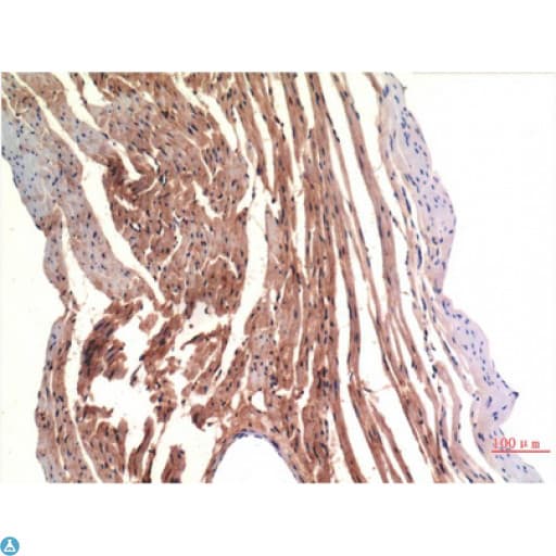 CD144 / CDH5 / VE Cadherin Antibody