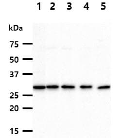 XPA Antibody (clone AT71H3)