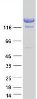 Human A2ML1 Protein (Recombinant Myc-DDK (Flag))