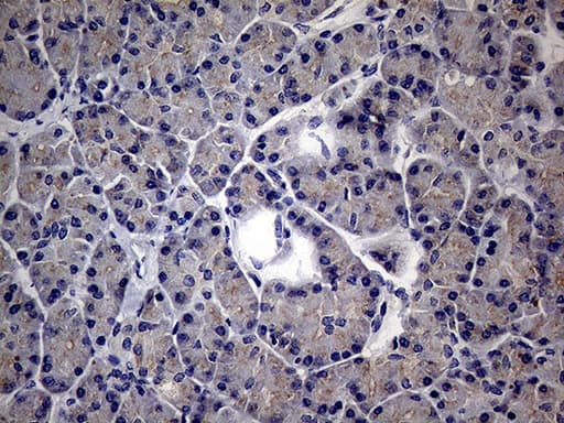 MAK Antibody (aa291-623, clone OTI1G2)