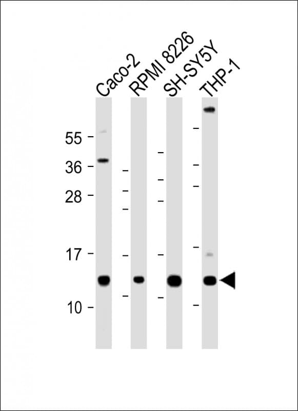 CKS2 Antibody (C-Terminus)