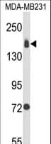 ITGA2 / CD49b Antibody (aa1023-1049)
