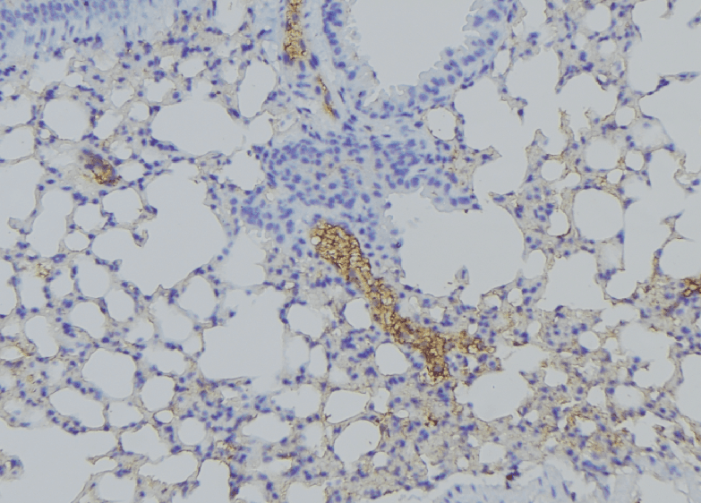 Polyclonal Rabbit anti-Human HSP90B1 / GP96 / GRP94 Antibody (IHC, IF, WB)
