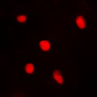BTEB / KLF9 Antibody