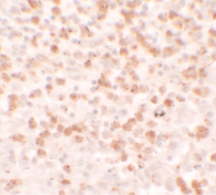 CCL17 / TARC Antibody