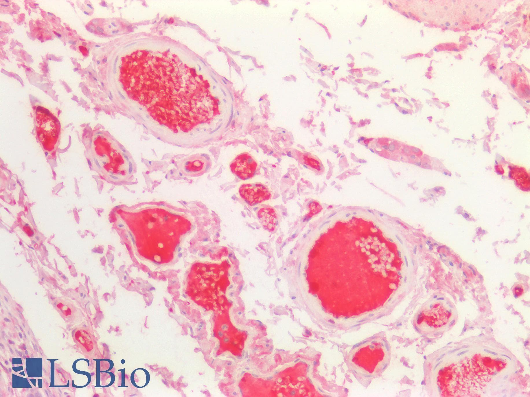 PathPlus™ KNG1 / Kininogen / Bradykinin Antibody (aa1-416)