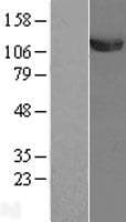 UBA1 / UBE1 Protein (Over-Expression Lysate Myc-DDK (Flag))