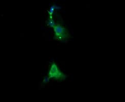 RARRES1 Antibody (clone OTI1D2, Carrier-free)