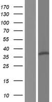Human FAM71F2 Protein (Over-Expression Lysate Myc-DDK (Flag))