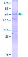 Human CENPT Protein (Recombinant GST)