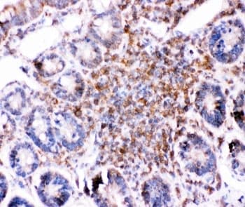 Polyclonal Rabbit anti-Human BID Antibody (aa1-195, IHC, WB)