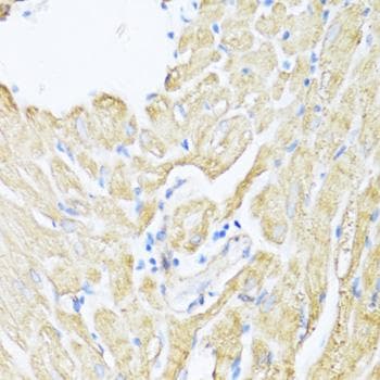 ALOX12 / 12 Lipoxygenase Antibody