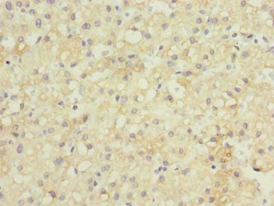 GDF2 / BMP9 Antibody (aa300-429)