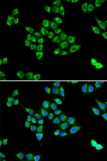 IHC-plus™ PC / Pyruvate Carboxylase Antibody