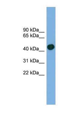 Polyclonal Rabbit anti-Human ACTRT1 Antibody (aa287-336, WB)